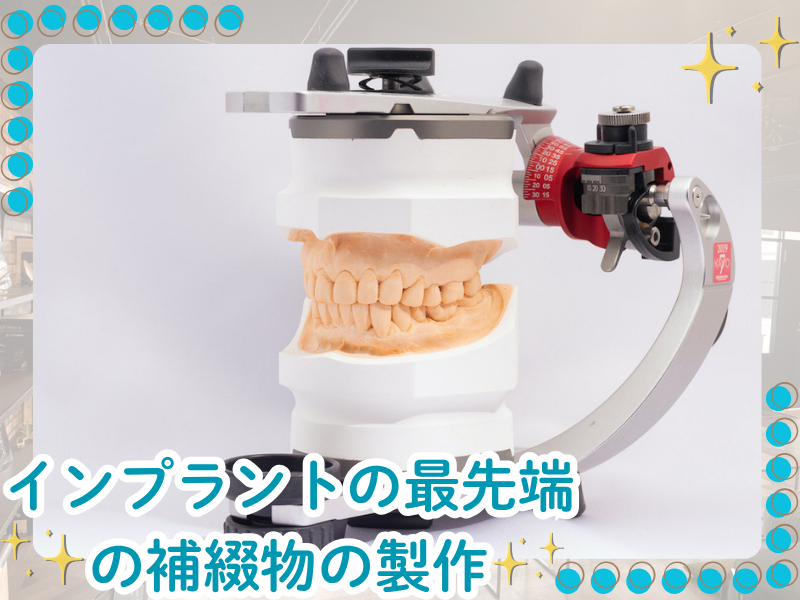 QLデンタルメーカー株式会社のアルバイト・バイト求人情報-03